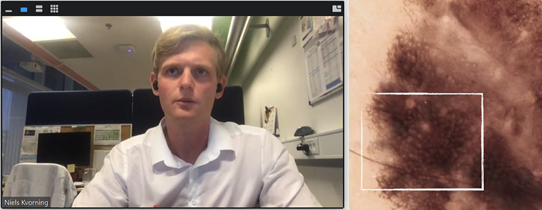 Niels Kvorning, CEO & Founder, Melatech speaking at a Copenhagen Science City Brew Your Own webinar about Artificial Intelligence in start-ups